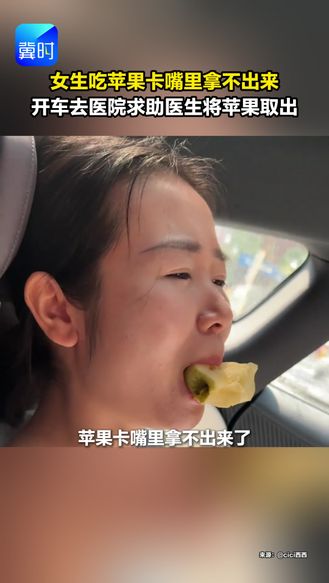 女生吃苹果卡嘴里拿不出来，开车去医院求助医生将苹果取出。